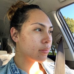 Nature’s Confidence - Post facial/extractions/LED light/jelly mask. Carla did the WORKS.