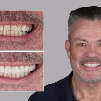 Livewell Dental - Cosmetic Dentists Near Me - Fairfax Station, Virginia Livewell Dental - Cosmetic Dentists Near Me - Fairfax Station, Virginia
