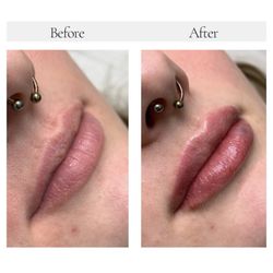 Noor Laser Center