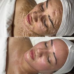 Nelly B Beauty Studio - DMK Enzyme therapy