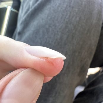 Unique Nails & Spa - Damaged and cut cuticles and nails. - Nail Salons Near Me - Temecula, California Unique Nails & Spa - Damaged and cut cuticles and nails. - Nail Salons Near Me - Temecula, California