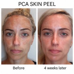 Esthetics by Roxanne - If you want to fade your discoloration and even skin tone, give me a call. 415.655.9769