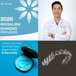 Legacy Dental Pasadena - Diamond Invisalign Provider  Dr. Sean has great success in providing Invisalign. Schedule a free video consult!