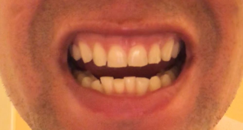 GENTLE DENTAL HAYWARD 13 Photos & 74 Reviews General Dentistry