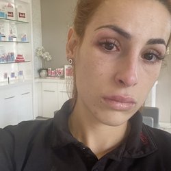 Amazing Lash Studio - No solution