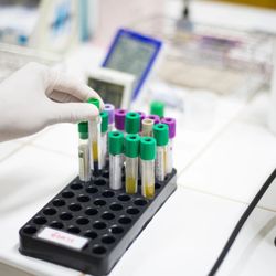 Simply Draw Phlebotomy - Mobile blood testing service.
