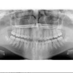 Ellie Orthodontics - Say CHEESE!