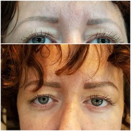 top : before, bottom : after top : before, bottom : after