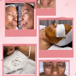 Fadia Beauty - Reveal smoother, brighter skin with derma-planing facial