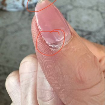 Amazing Nails - Chipped acrylic. Lifting edges. Sloppy finishing. - Nail Salons Near Me - San Rafael, California