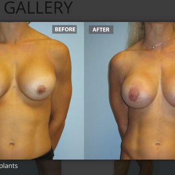 Deepak Naidu MD - Cosmetic Surgeons Near Me - Tampa, Florida