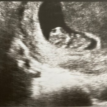 Baby Bump Studios - 9 weeks ultrasound! - Diagnostic Imaging Near Me - Ontario, California Baby Bump Studios - 9 weeks ultrasound! - Diagnostic Imaging Near Me - Ontario, California