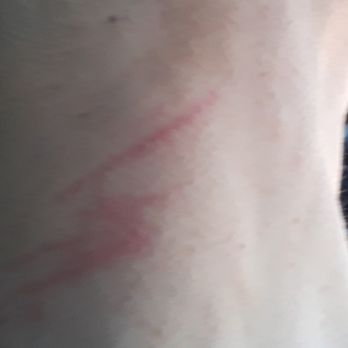 Henry's Woodlands Barber Shop - Both sides of my neck look like I got in a fight with a cat! - Barbers Near Me - Spring, Texas Henry's Woodlands Barber Shop - Both sides of my neck look like I got in a fight with a cat! - Barbers Near Me - Spring, Texas