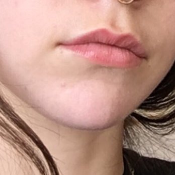 Laurel Cosmetic Tattoo - After lip blush! Just wearing Aquaphor balm. - Tattoo Near Me - New York, New York Laurel Cosmetic Tattoo - After lip blush! Just wearing Aquaphor balm. - Tattoo Near Me - New York, New York