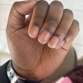 Glamour Nails - Before manicure/dip nails - Nail Salons Near Me - Wauwatosa, Wisconsin Glamour Nails - Before manicure/dip nails - Nail Salons Near Me - Wauwatosa, Wisconsin