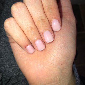 Miracle Nails and Spa - My cut cuticles from the file (on my pinky, middle finger, and pointer) - Massage Near Me - Troy, New York Miracle Nails and Spa - My cut cuticles from the file (on my pinky, middle finger, and pointer) - Massage Near Me - Troy, New York