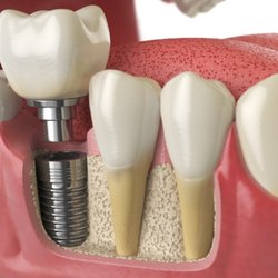 William A Steiner, DDS