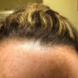 One day later, the highlights should not be this far from ones scalp!