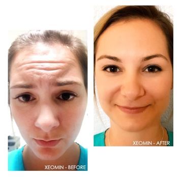 Ann Webb Skin Clinic - Skin Care Near Me - Houston, Texas Ann Webb Skin Clinic - Skin Care Near Me - Houston, Texas