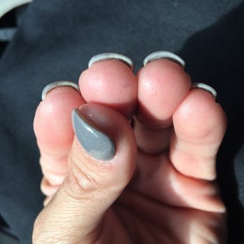 eXtreme nails & spa - Thick all around and uneven - Nail Salons Near Me - Littleton, Colorado eXtreme nails & spa - Thick all around and uneven - Nail Salons Near Me - Littleton, Colorado