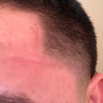 The Spot - Areas where Kane pressed too hard with the clippers - Barbers Near Me - Oceanside, California