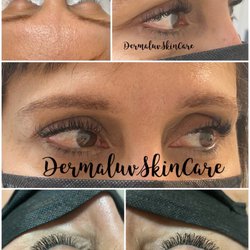 Dermaluv Skin Care