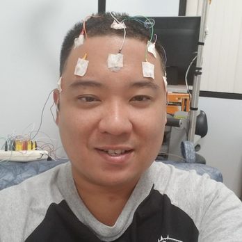 Hawaii Pacific Neuroscience - I'm all wired from Keith & ready for my EEG testing to begin. - Neurologist Near Me - Honolulu, Hawaii Hawaii Pacific Neuroscience - I'm all wired from Keith & ready for my EEG testing to begin. - Neurologist Near Me - Honolulu, Hawaii