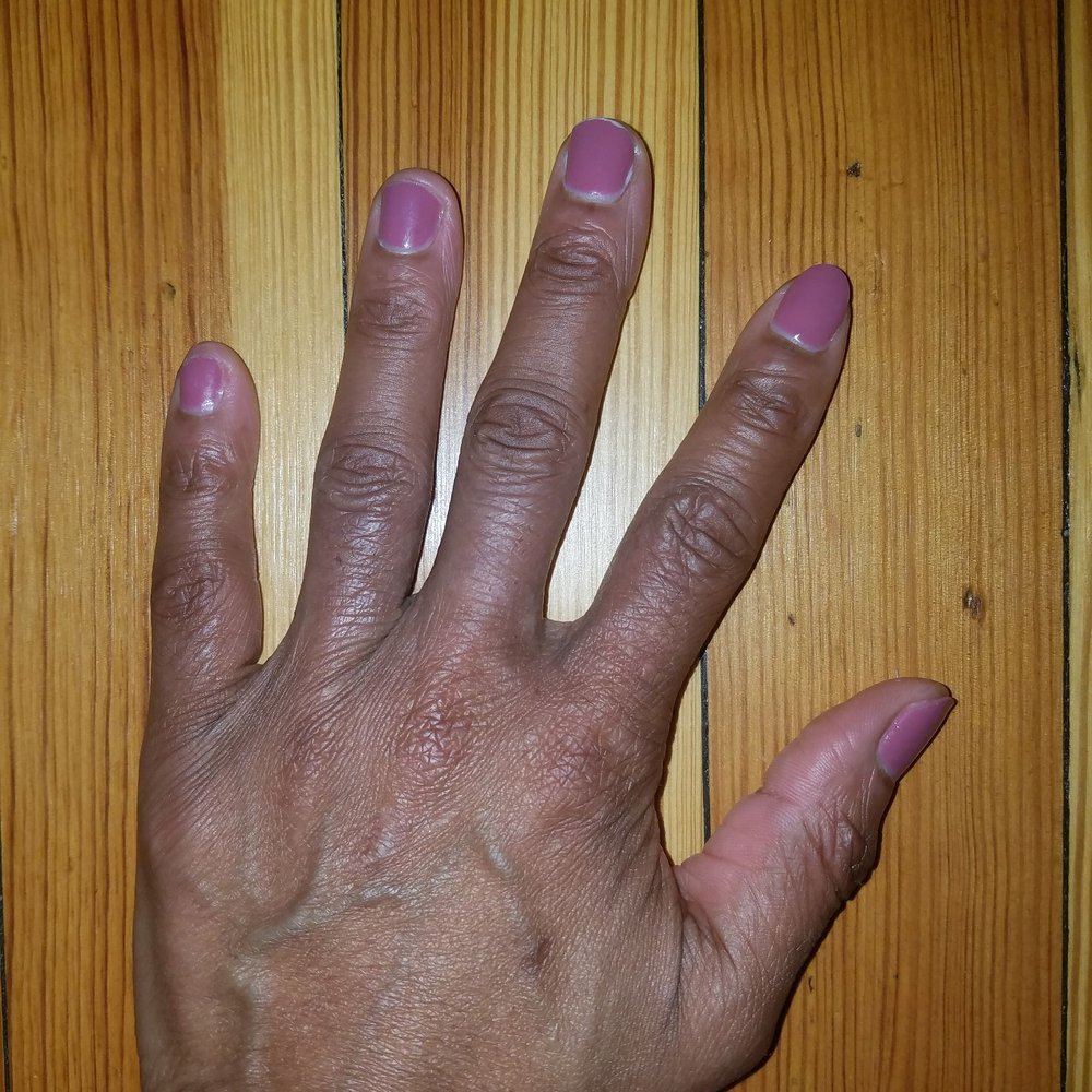 9/28/19 pic of my nails breaking down to the nailbeds after 9/22/19 manicure. 9/28/19 pic of my nails breaking down to the nailbeds after 9/22/19 manicure.