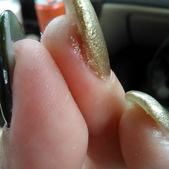 CK Nails - I had to peel gel polish off of my fingers as well. - Nail Salons Near Me - Renton, Washington