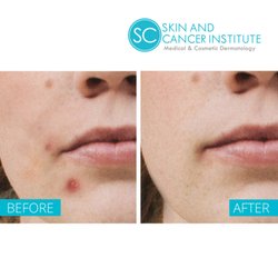 Skin And Cancer Institute - Arroyo Grande
