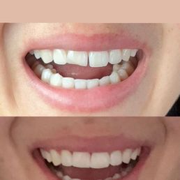 here is a before and after for reference here is a before and after for reference