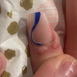 Queen Nails - Ohhh and btw my kid caught an allergic skin reaction from their tools . Don't f w this place - Nail Salons Near Me - Mahopac, New York