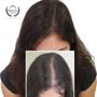 Photo of Scalp Co - Scalp Micro Pigmentation