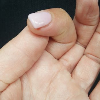 Holly Nails - Deep knick hurts so bad! - Nail Salons Near Me - Auburn, California Holly Nails - Deep knick hurts so bad! - Nail Salons Near Me - Auburn, California