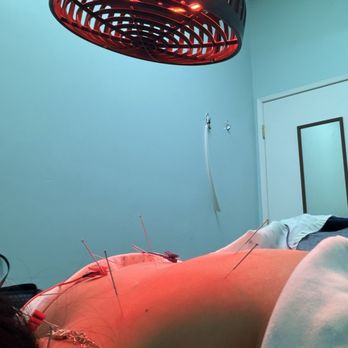 Shen Clinic - Acupuncture - Acupuncture Near Me - Gardena, California Shen Clinic - Acupuncture - Acupuncture Near Me - Gardena, California
