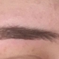 One Touch Beauty - Close up of my bald spot she gave me.