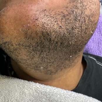 Glabrous Glamour - Hair Removal Near Me - Plano, Texas