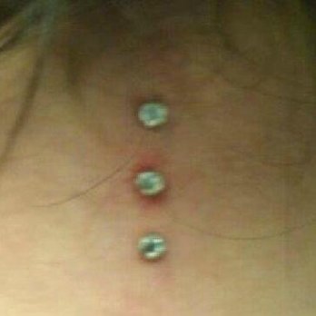 Hold Steady Tattoo - Dermals. This was taken at the time of piercing. - Piercing Near Me - West Warwick, Rhode Island