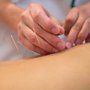 NY Four Seasons Acupuncture