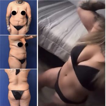 Emil Kohan, MD - Plastic Surgeons Near Me - Beverly Hills, California Emil Kohan, MD - Plastic Surgeons Near Me - Beverly Hills, California