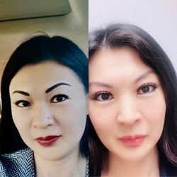 Beauty Up Skin - Microneedling with PRP
