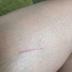 Scratch