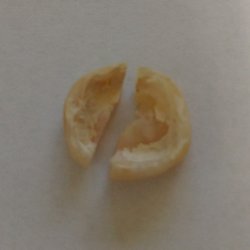 Hamid R Janloo, DDS - Do not get a crown from here.