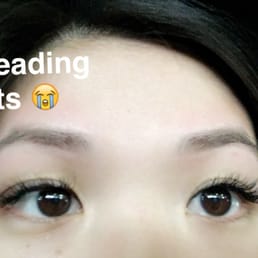 Sorry no before photo, but these are my eyebrows before makeup! Redness was gone in an hour Sorry no before photo, but these are my eyebrows before makeup! Redness was gone in an hour