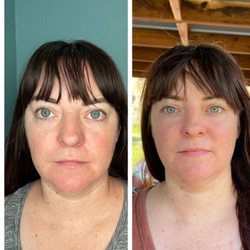 Solyn Skin Fitness Studio - 6 facial Glow with the Flow facial reflexology treatment!