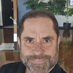 Bosley Hair Restoration & Transplant - After 8 months