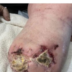 Redlands Community Hospital - Dr Prince's work