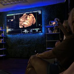 Baby Bloom Ultrasound