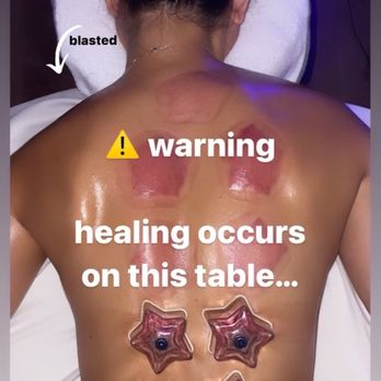 Beauty and the Chi - Cupping and fascia blasting - Reiki Near Me Beauty and the Chi - Cupping and fascia blasting - Reiki Near Me