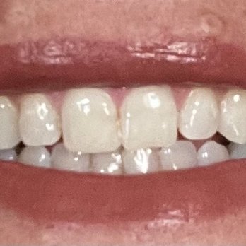 Reynolds Wendy DDS - All fixed up!! :) - Oral Surgeons Near Me - Park City, Kansas Reynolds Wendy DDS - All fixed up!! :) - Oral Surgeons Near Me - Park City, Kansas